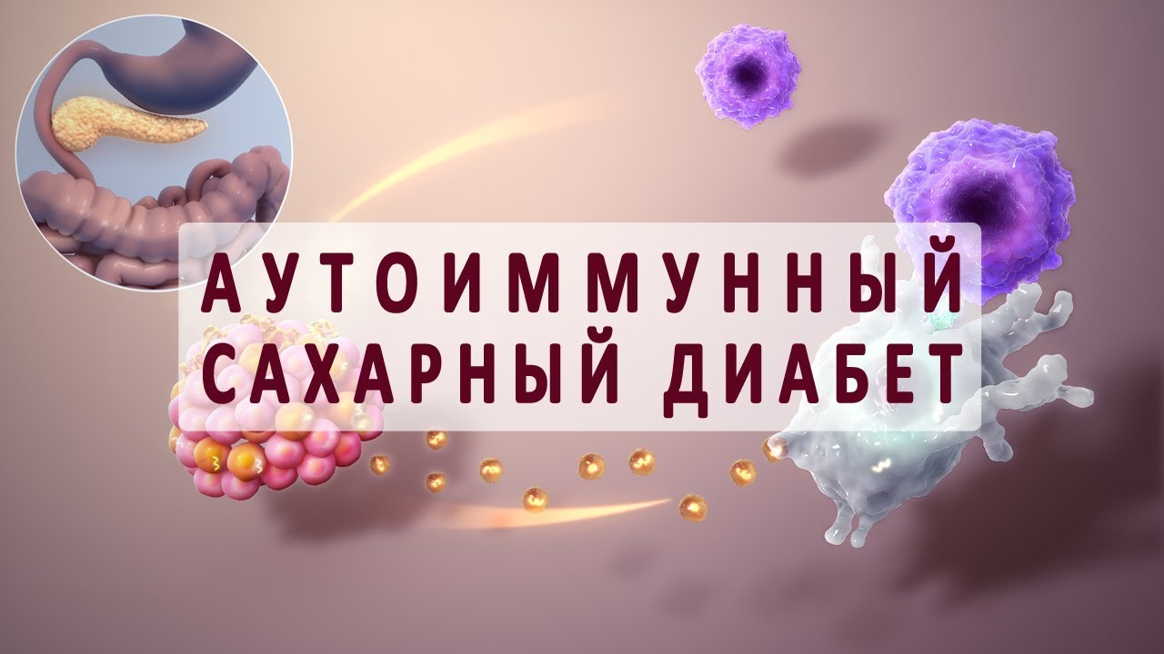 Что такое аутоиммунный сахарный диабет?