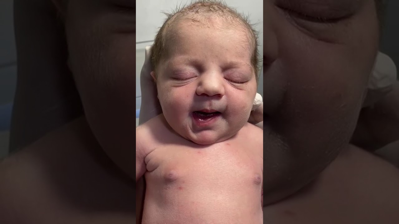 Cute NICU Baby Recovered from IDM 💖 Nurse Love & Care 🤲❤️