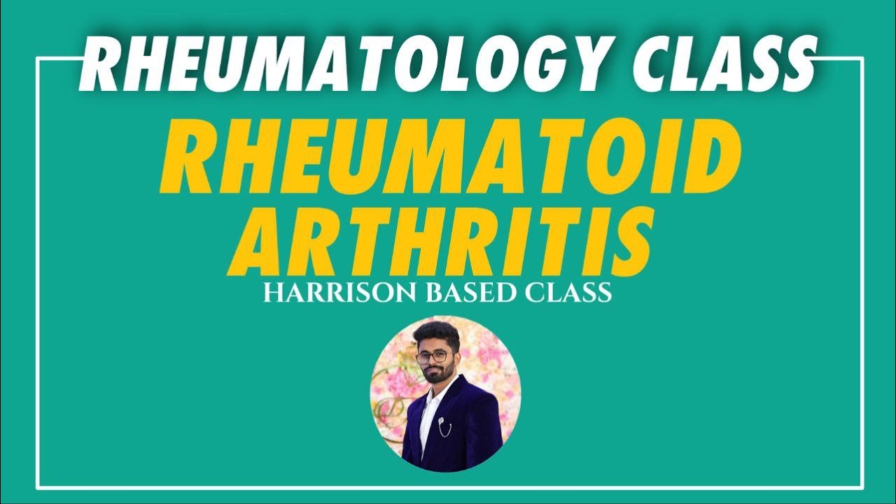Rheumatology Harrison based class - RHUEMATOID ARTHRITIS 🔸