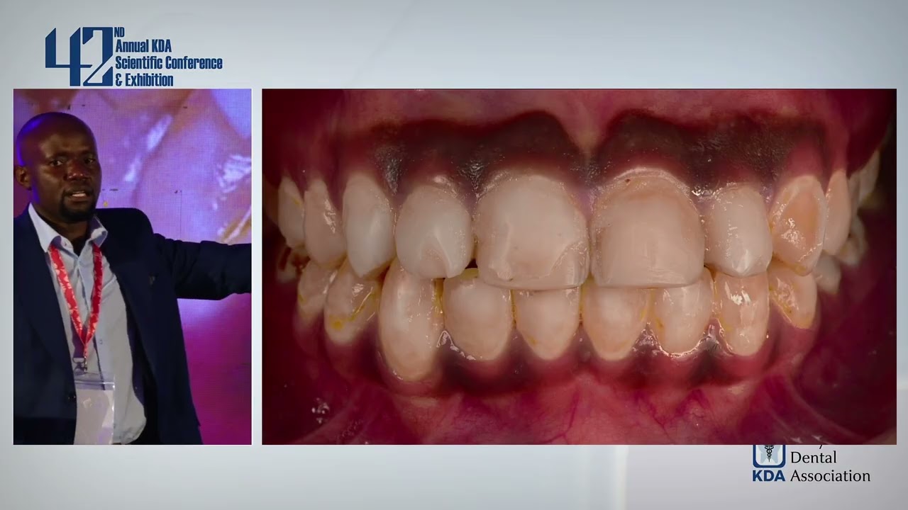 Conservative Dentistry By Dr Godfrey Obaigwa- 42nd ASCE