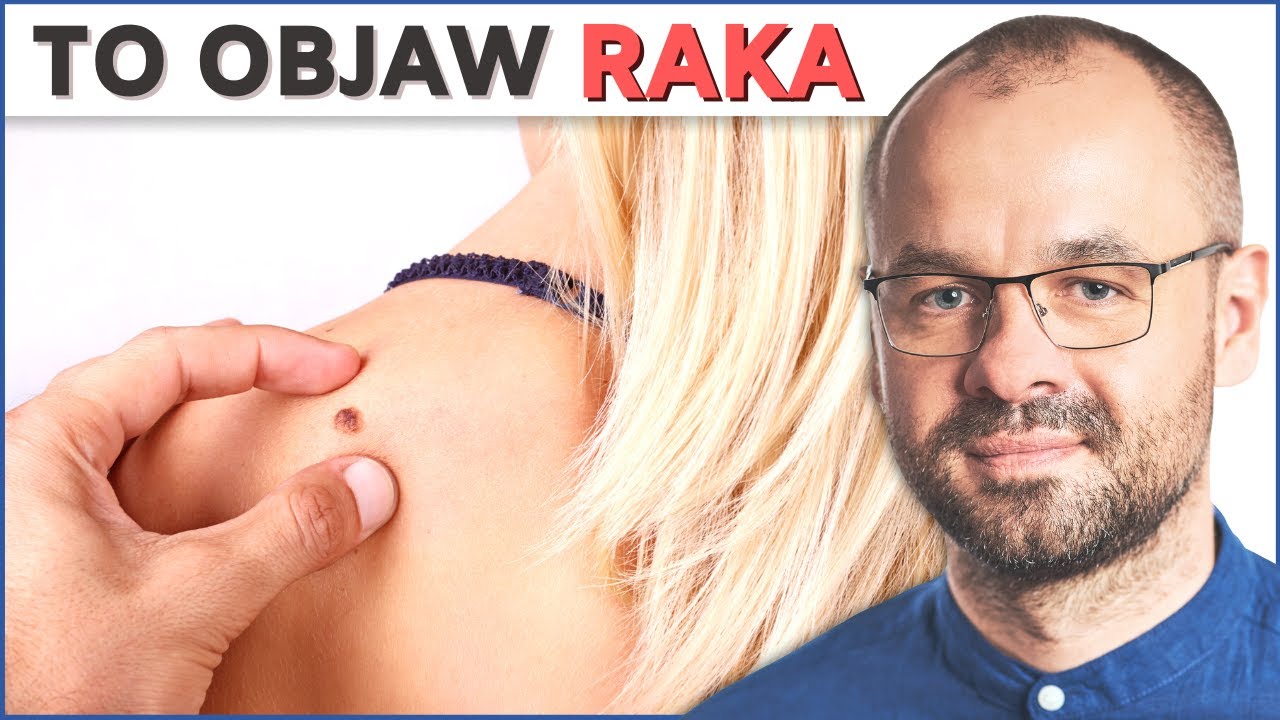 Wczesne objawy RAKA. Masz ten objaw?