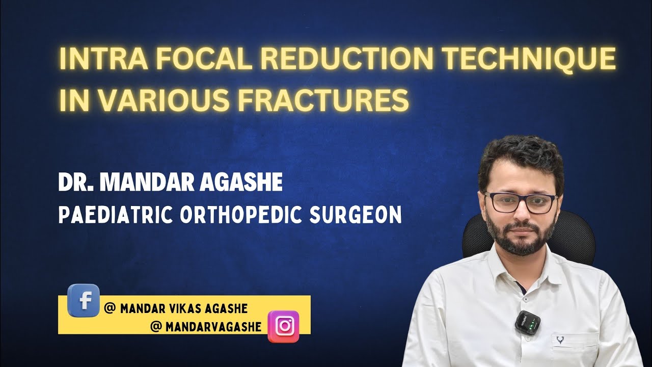 Intrafocal reduction techniques in fractures | Dr. Mandar Agashe, Pediatric Orthopedic Surgeon
