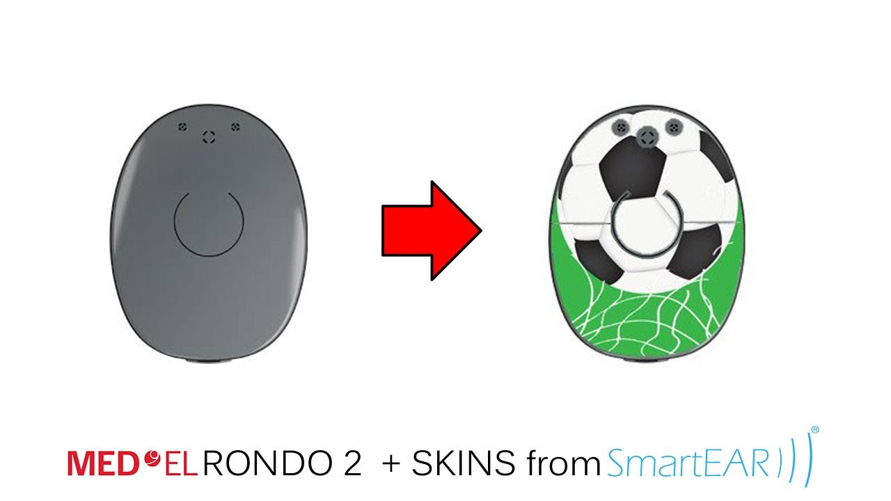 Installing a SmartEar skins on a MED-EL Rondo 2 audio processor (subtitles ENG, DE, ES)