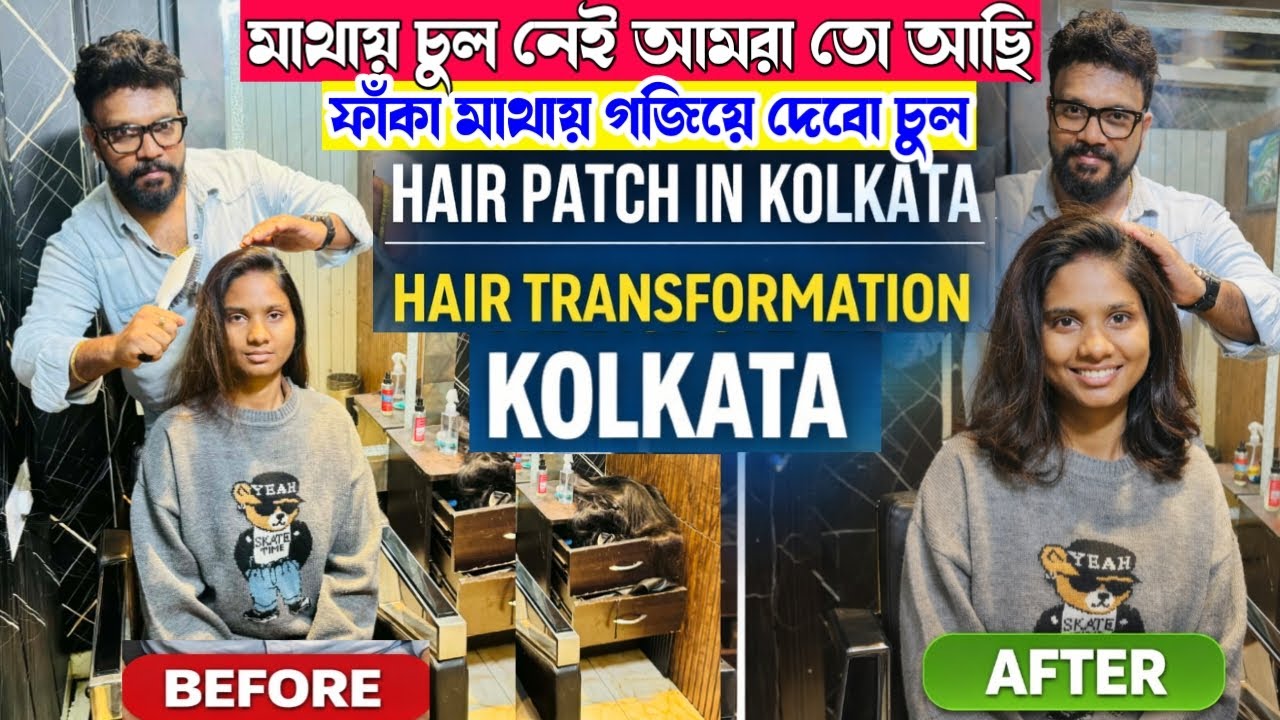 মাথায় চুল নেই? চিন্তা নেই—আমরা তো আছি!💇‍♂️✨Best Hair Patch in Kolkata | Hair Transformation Kolkata