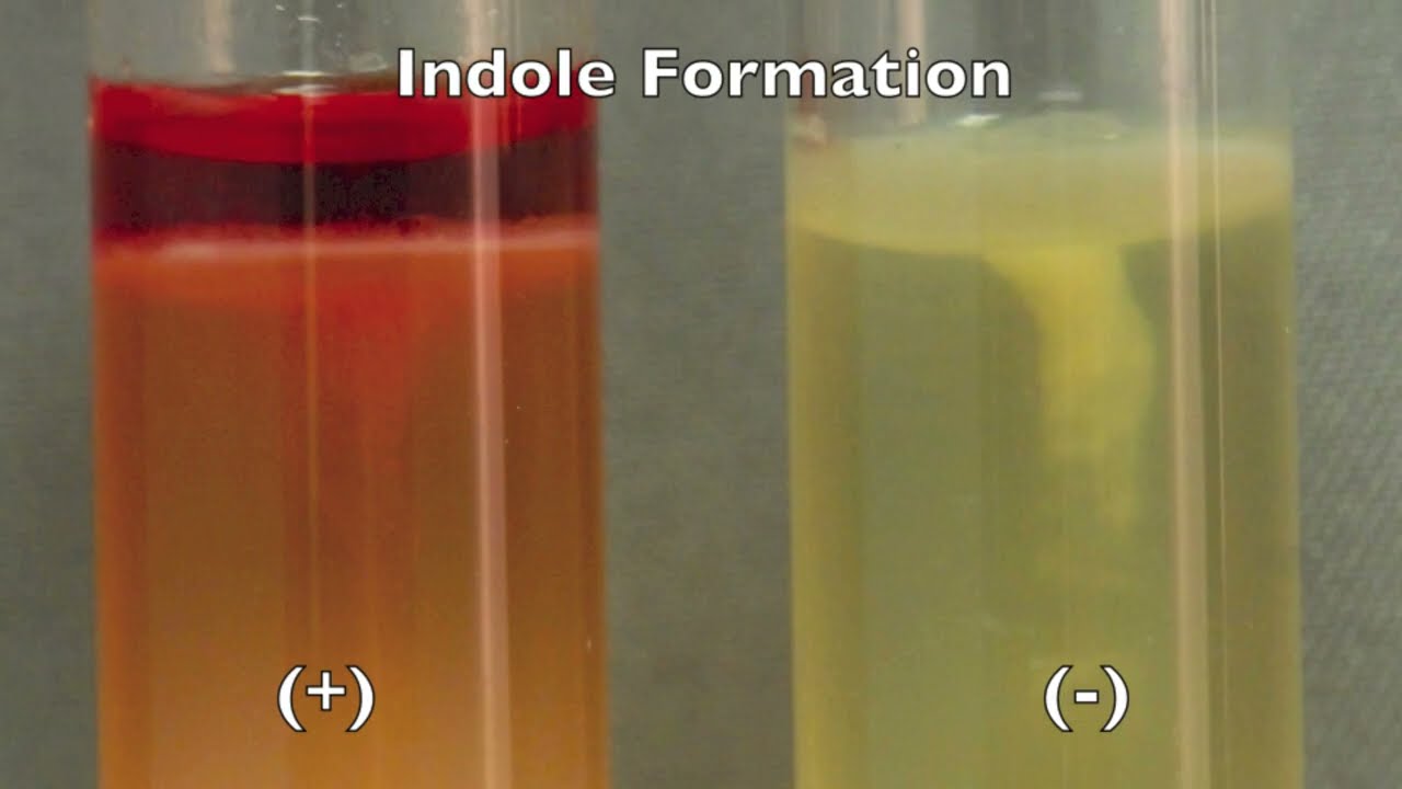 SIM medium. An essay if microbes produce hydrogen sulfide, form indole, and exhibit motility.