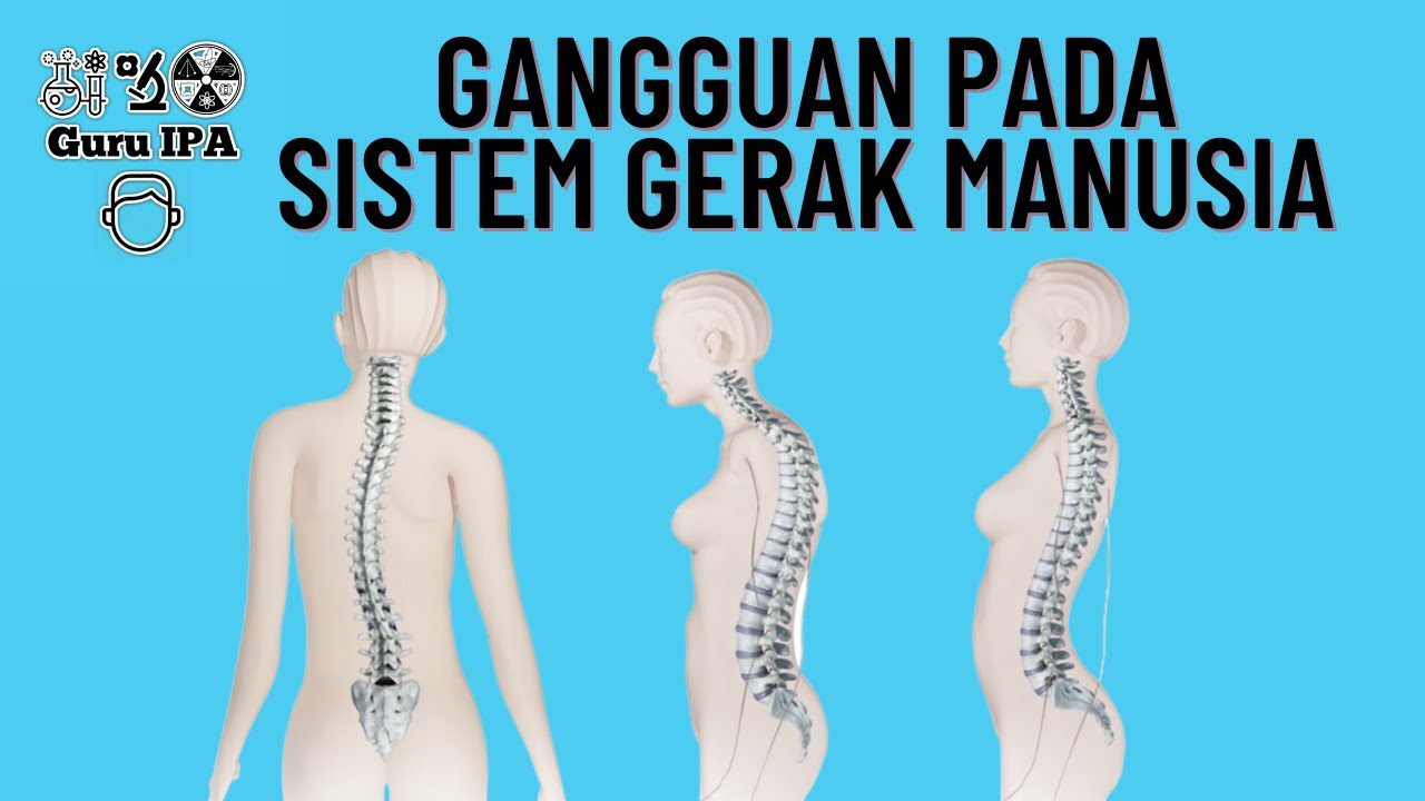 gangguan dan kelainan pada sistem gerak manusia