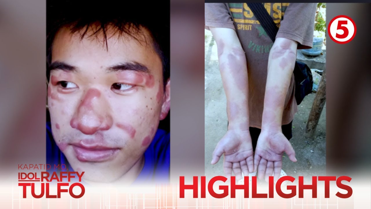 KAPATID MO, IDOL RAFFY TULFO | Binatang may ketong