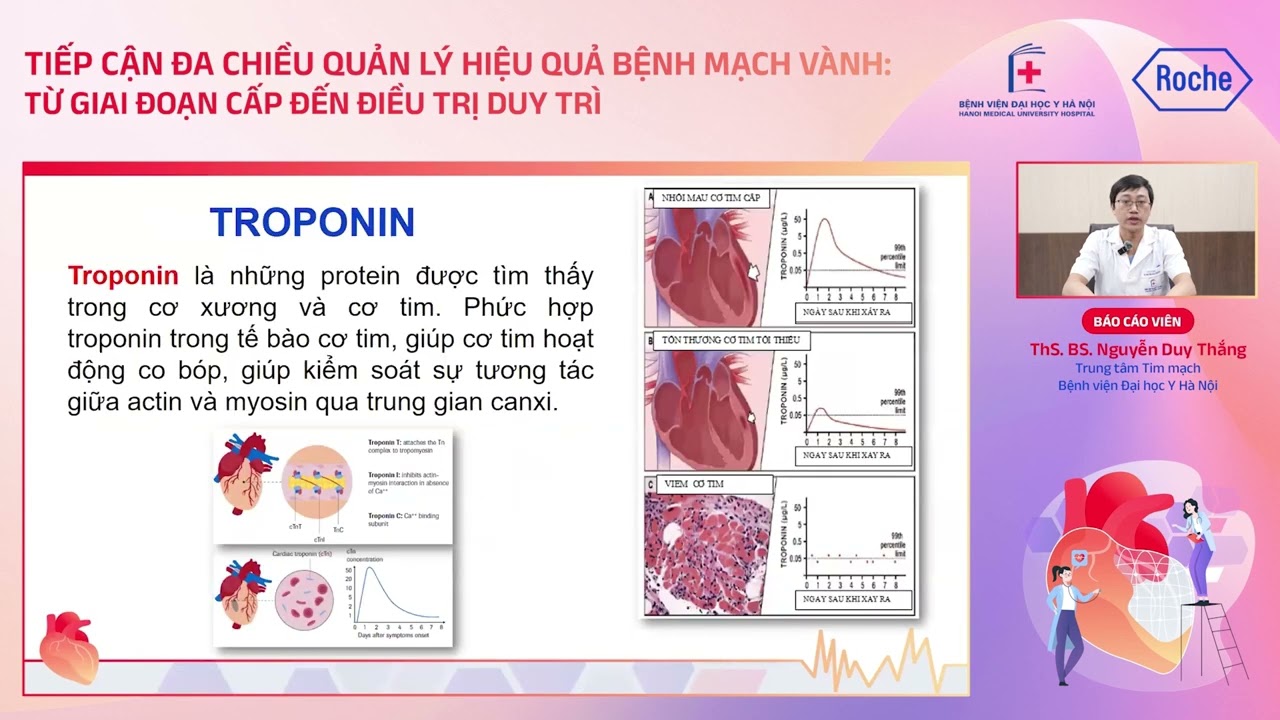 Chẩn đoán và điều trị hội chứng vành cấp không ST chênh lên