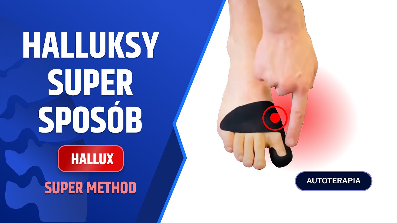 HALLUKSY - taping, masaż, ćwiczenia - techniki na paluch koślawy - dr n. med. Marcin Wytrążek