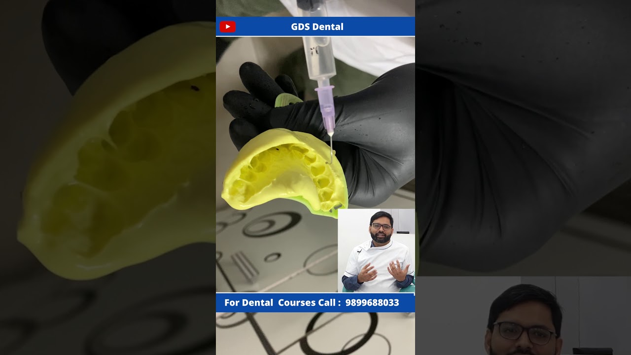 Acrylic Temporary Crown procedure & #fabrication  on Front Tooth- Chair side without Root Canal