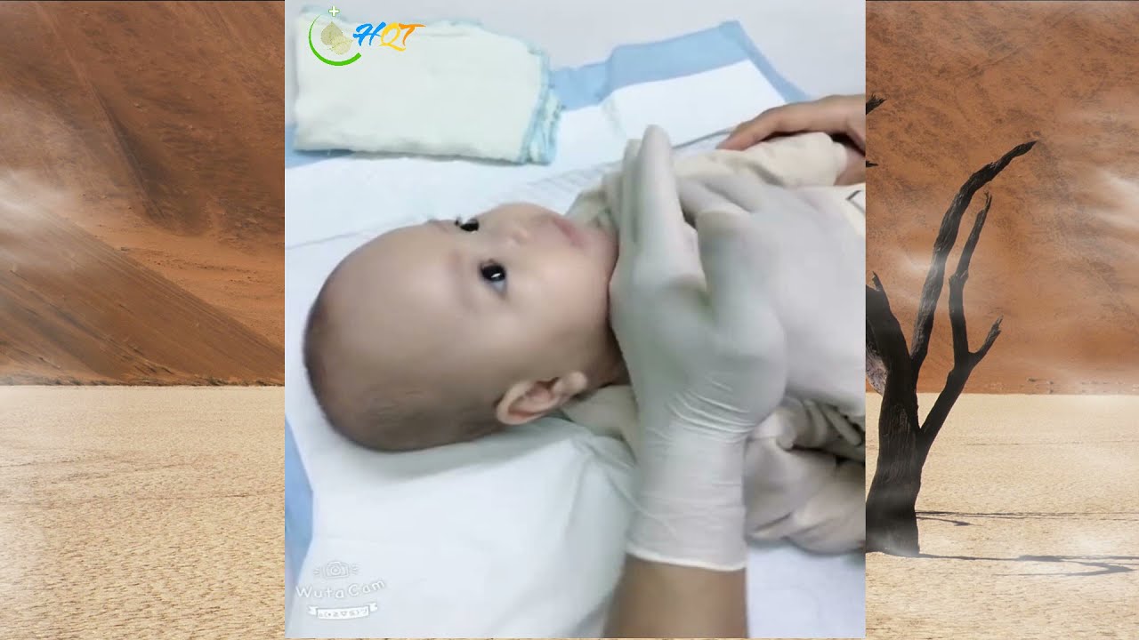 Vật lý trị liệu hô hấp ở trẻ - Phòng vỗ long đờm chú Trưởng