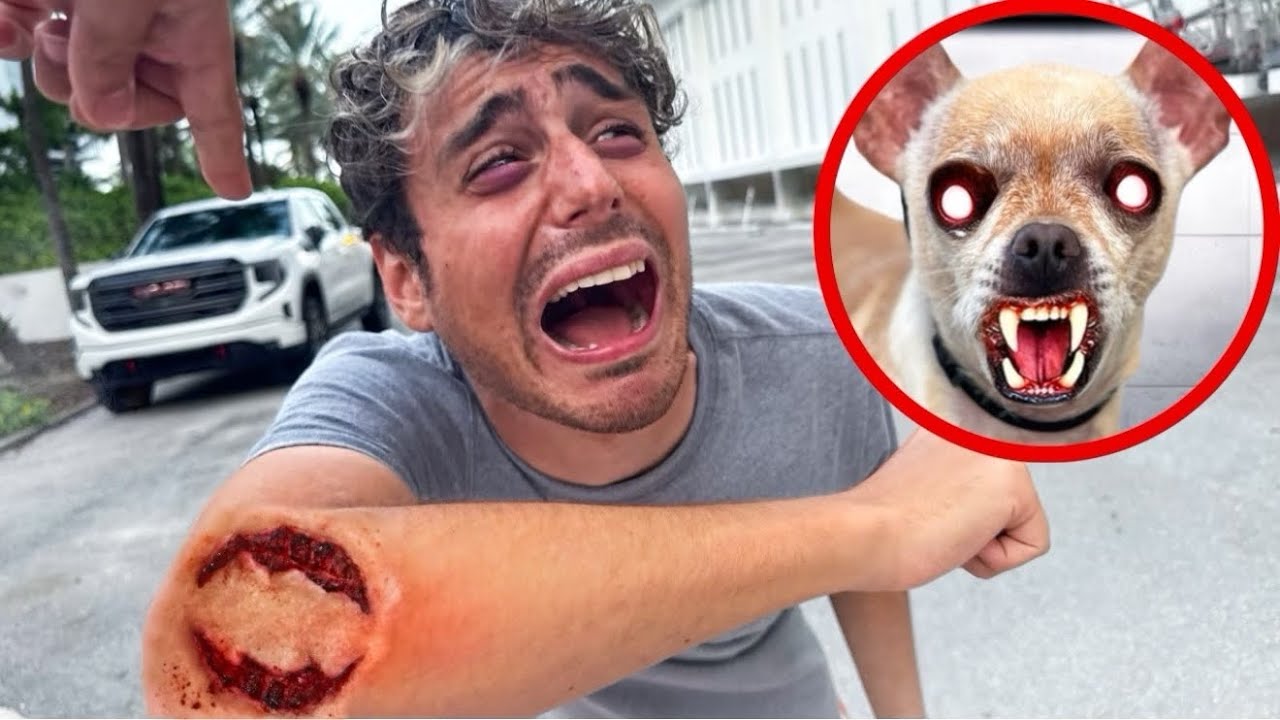 OUR POSSESSED DOG BIT JAMES&hellip;😰