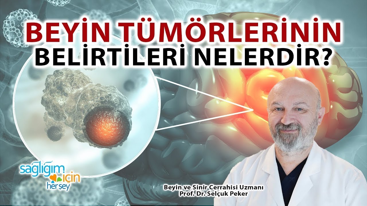 Beyin Tümörlerinin Belirtileri Nelerdir? - Prof. Dr. Selçuk Peker