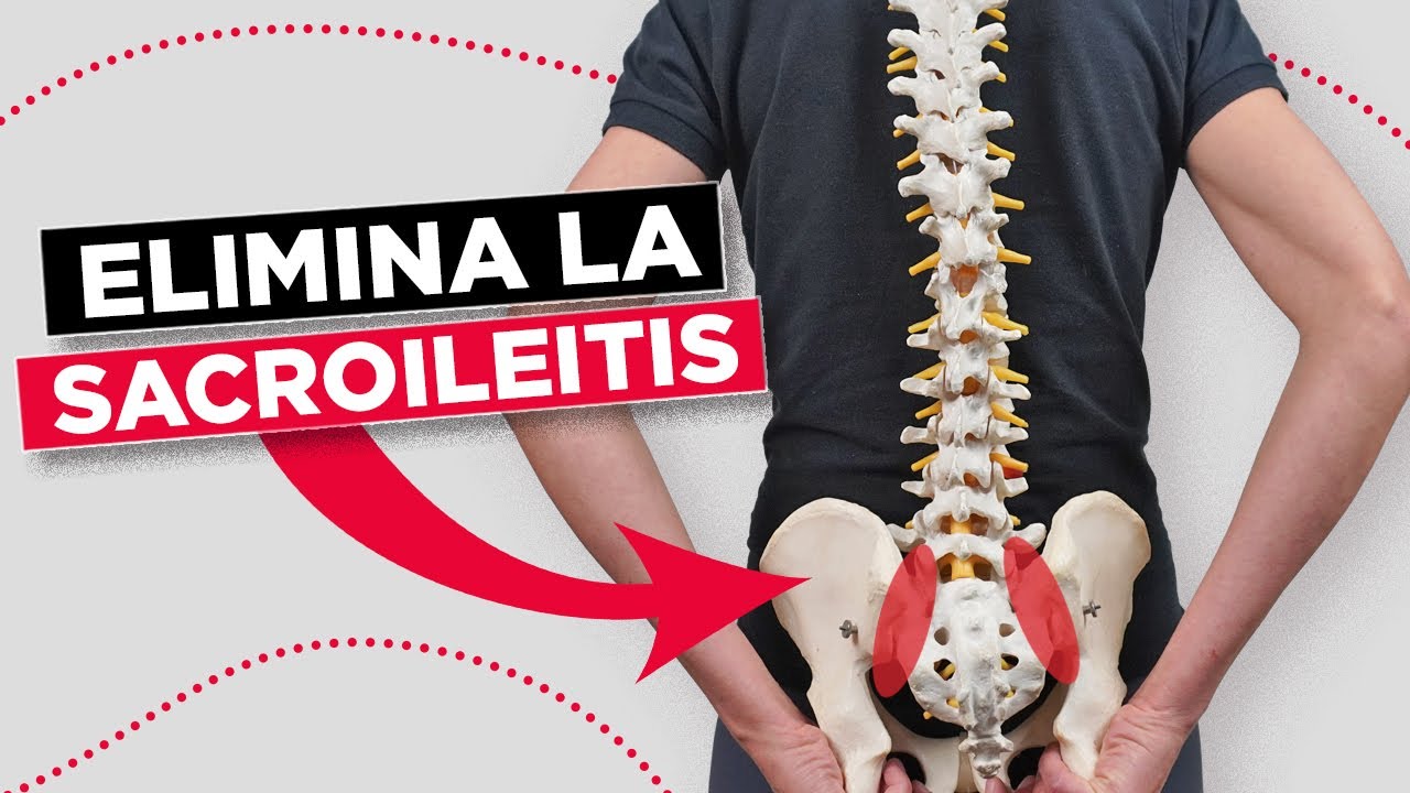 Desinflama Tu Articulación Sacroilíaca- Haz estos ejercicios para quitar la Sacroileitis