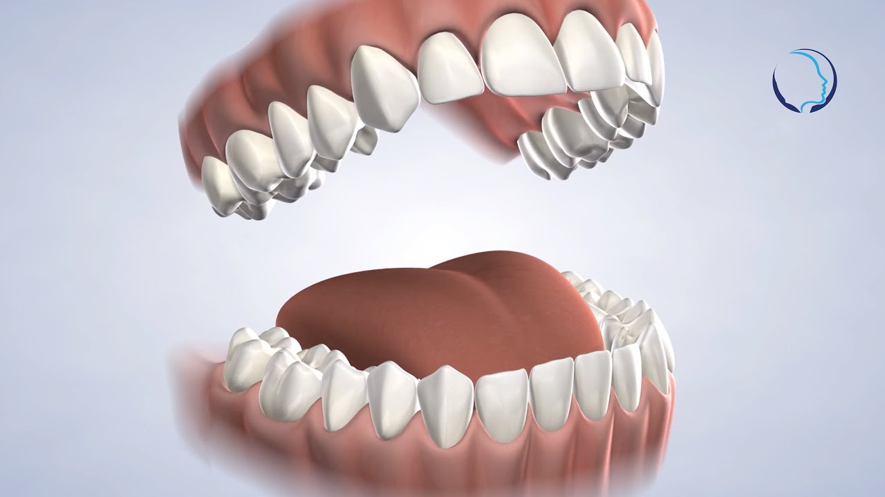 Post-Operative Instructions For Oral Surgery in Groton, MA