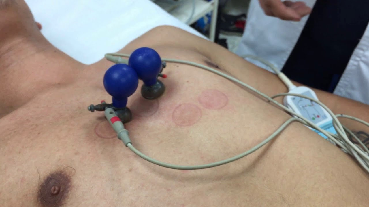 COMO TOMAR UN ELECTROCARDIOGRAMA