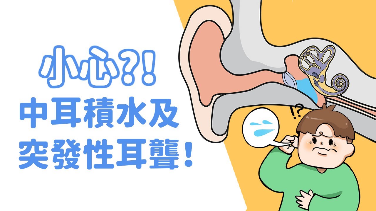 小心！中耳積水及突發性耳聾！【引起耳朵悶塞感的疾病(下)】