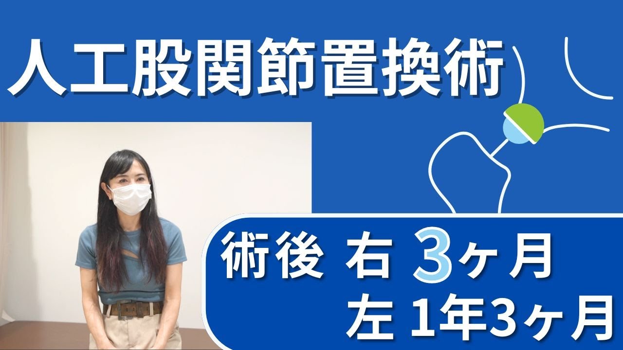 ​人工股関節置換術　術後（右：約3ヶ月　左：約1年3ヶ月）