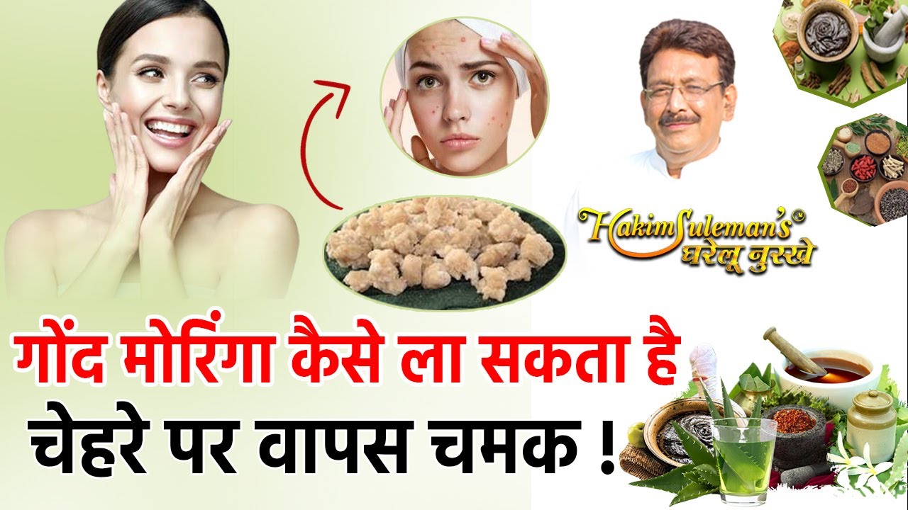 मुँह पर होने वाले मुंहासों के लिए ये गोंद मोरिंगा है फायदेमंद!