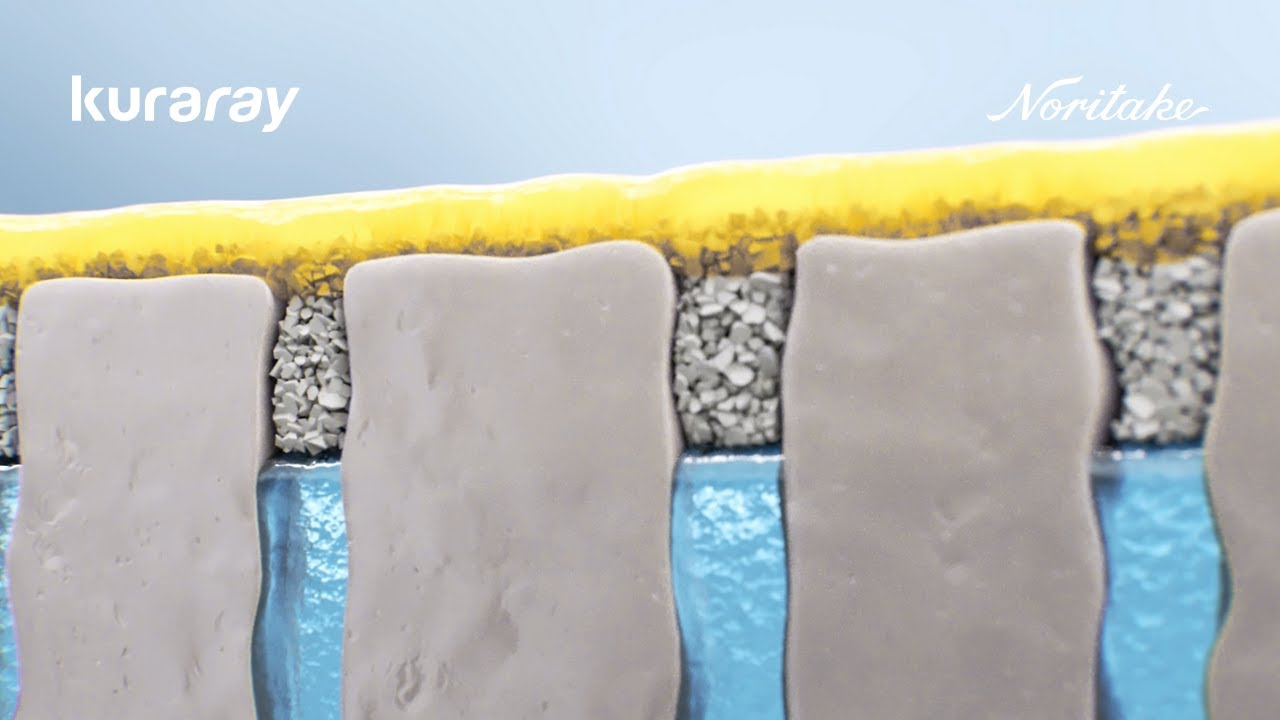 CLEARFIL Universal Bond Quick 2 | Advanced Rapid Bond Technology Explained