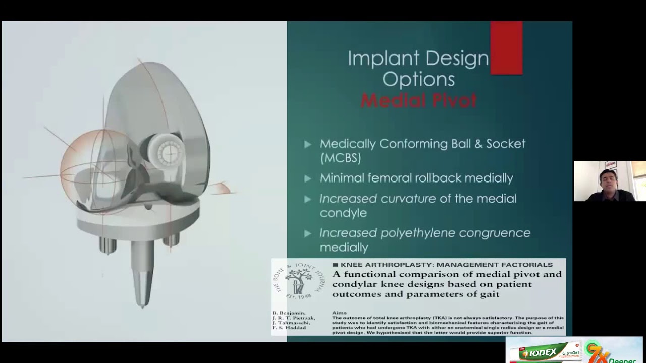 OrthoTV Original  - Kinematic Alignment vs Kinematic Implants - Dr Savyasachi Thakkar