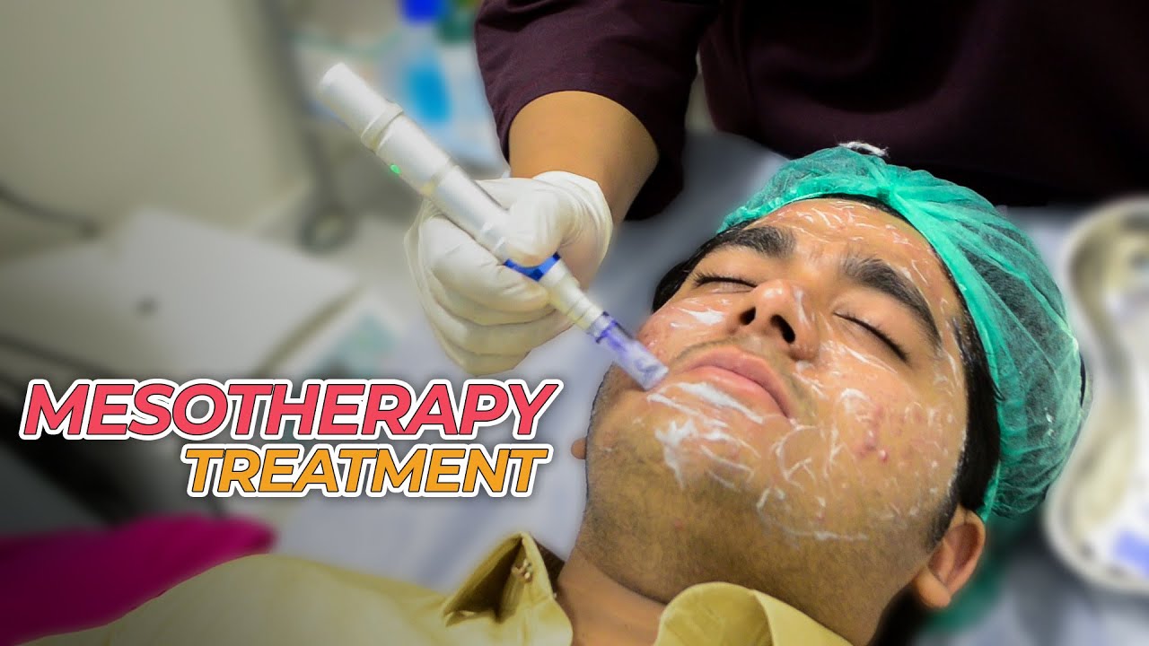 Mr. Faraz Getting Mesotherapy For ACNE SCARS