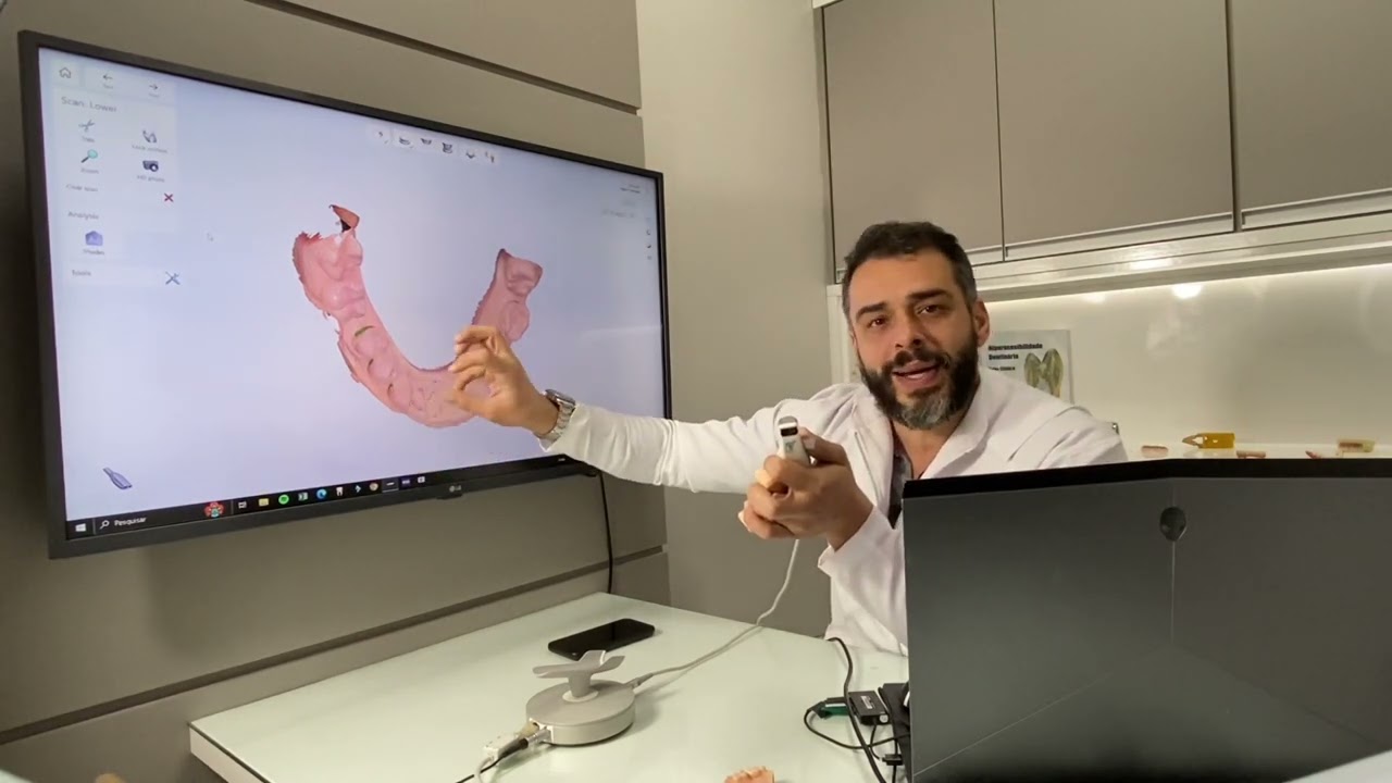 Aprenda  Escaneamento intra oral com o scanner 3Shape Trios
