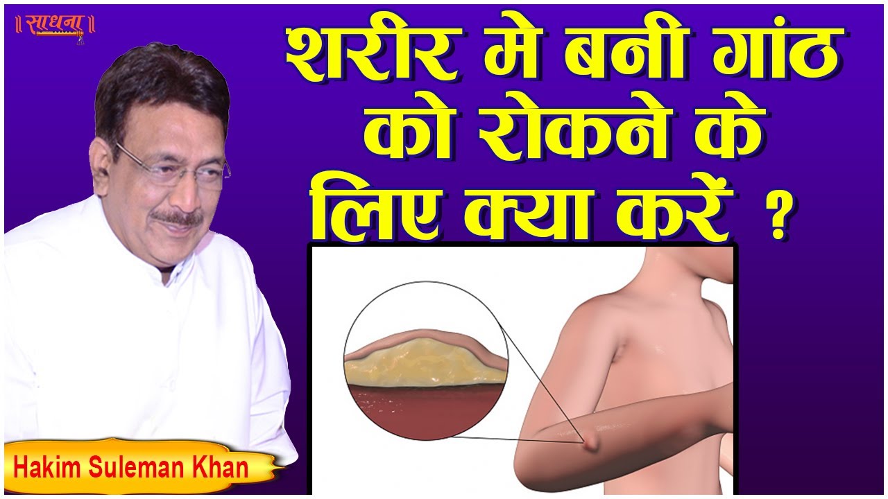 शरीर में बनी गाँठ को रोकने के लिए क्या करें ? Hakim Suleman Khan | Sadhna TV