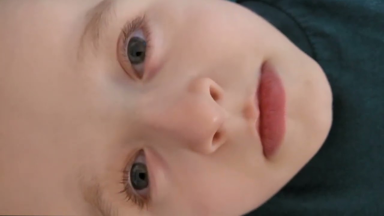Can BPPV Occur in Children? Rare Case of an 11-Year-Old Boy with Vertigo Explained