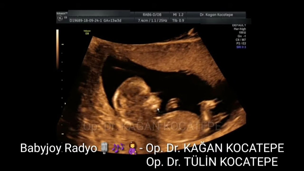 GEBELİKTE ULTRASON-3.BÖLÜM:BEBEK ÖLÇÜMLERİ, KİLOSU, BOYU, SIVISI, RENKLİ DOPPLER VE DETAYLI ULTRASON