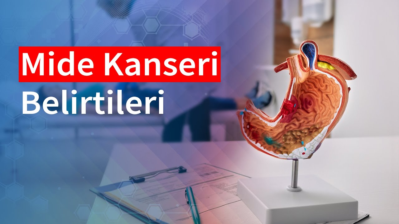 Mide Kanseri Belirtileri | Medical Park