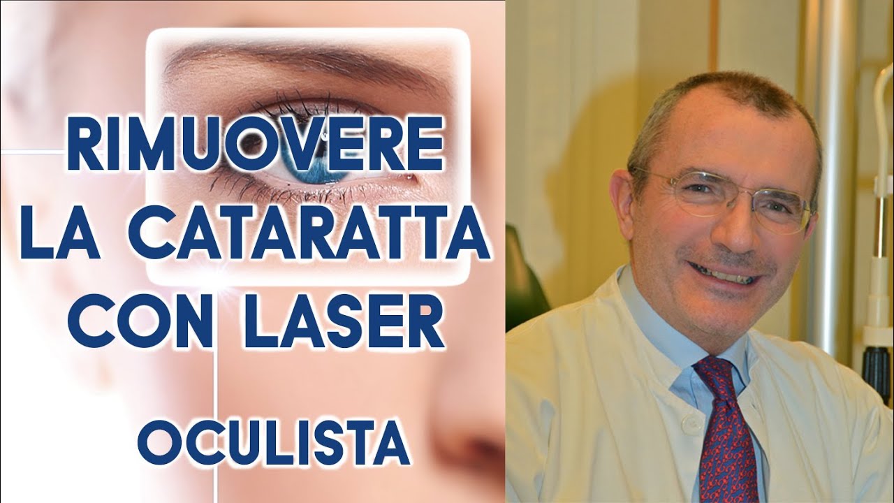 CATARATTA, RIMUOVERLA con LASER a Femtosecondi. Dott. Edoardo Ligabue