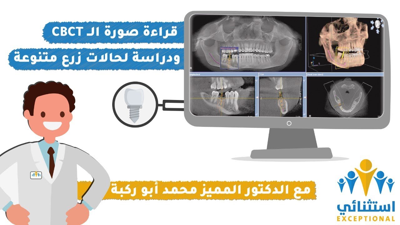 قراءة و دراسة صورة ال CBCT لحالات متنوعة | طبيب أسنان استثنائي