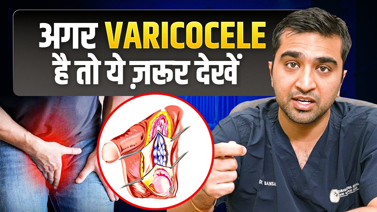क्या Varicocele से Testosterone कम होता है? | Varicocele Treatment Without Surgery