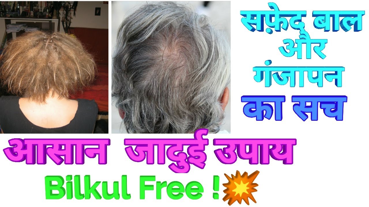 बाल सफेद होने के, झड़ने, रुसी, रूखे होने के पीछे का भयंकर सच  जानिए, Dr Shalini