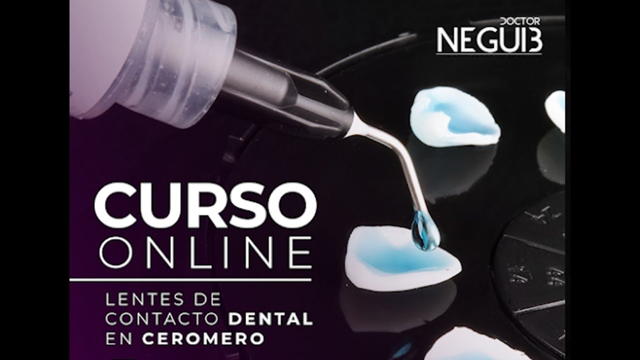 Carillas de Cerómero Monolítico: Módulo 4