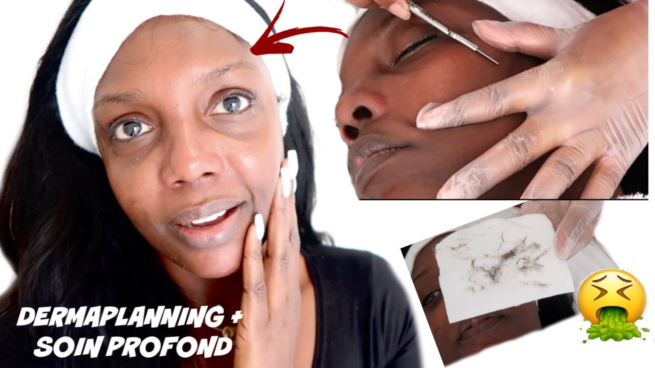 #VLOG: SOIN PROFESSIONNEL ! DERMAPLANNING + SOIN PROFOND / SOIN AU SCALPEL BY ABD_COSMETIQUE A PARIS