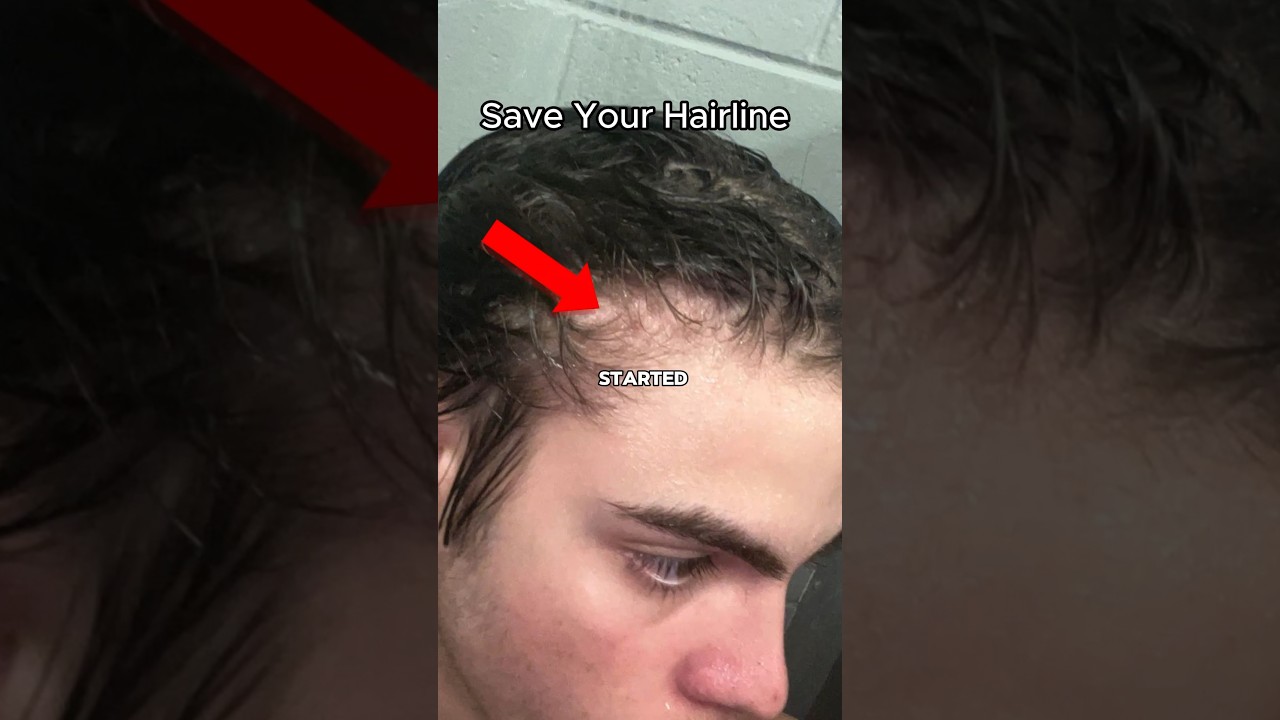 How to keep your hair from balding 😱