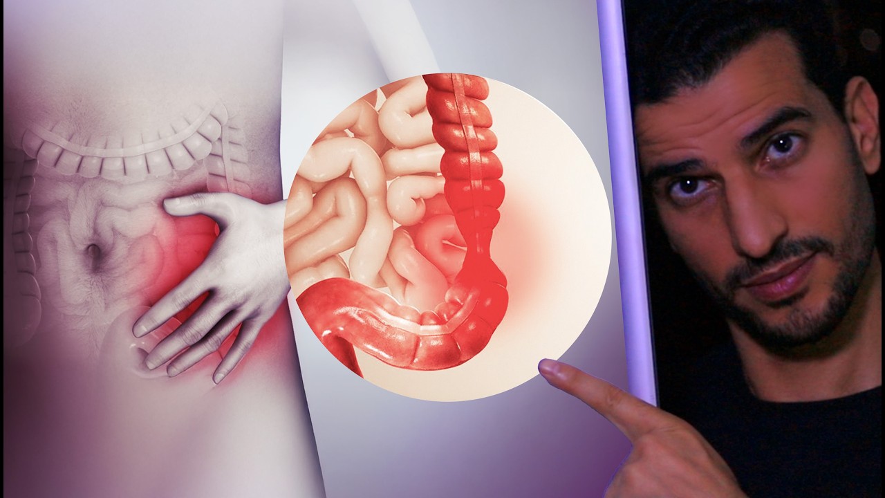 إلتهاب وألم القولون؟ إنتفاخات بدون سبب؟ العلاج اسهل مما تتخيل..
