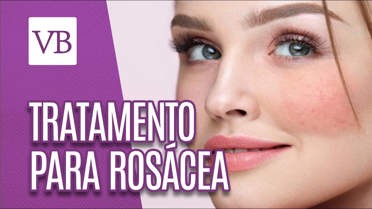 Tratamento para Rosácea - Você Bonita (17/10/18)