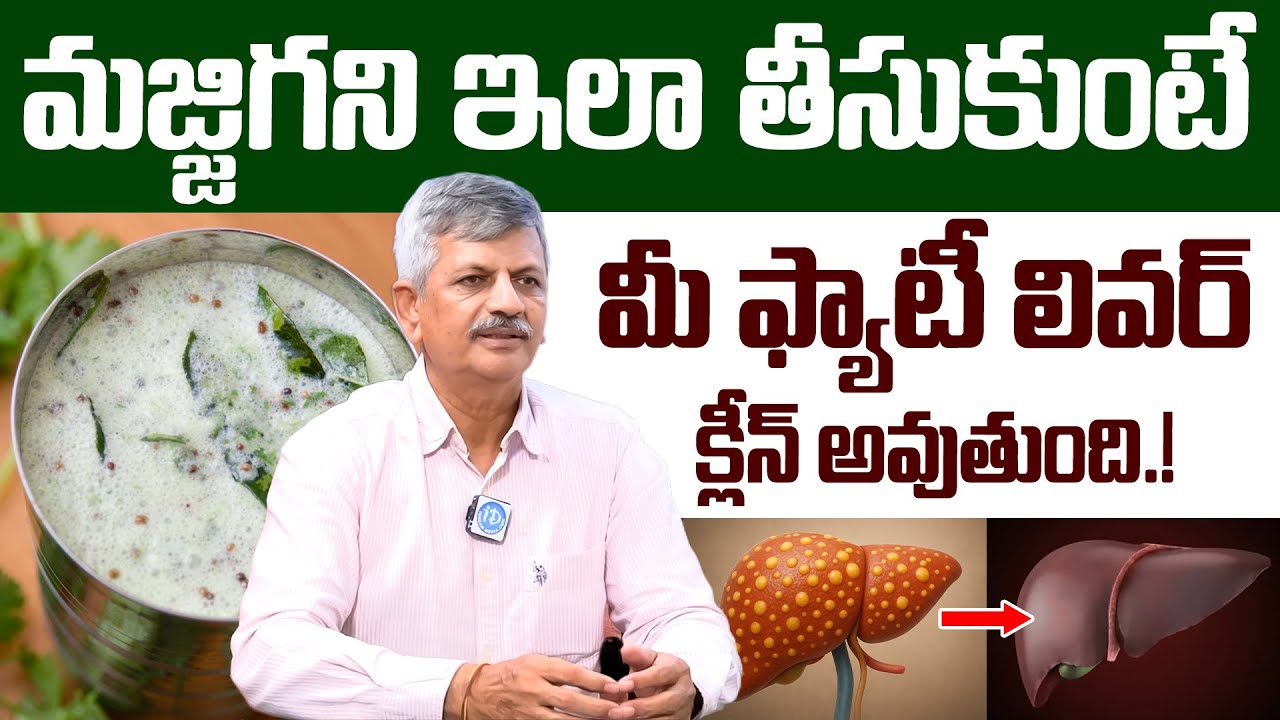 మజ్జిగతో ఫ్యాటీ లివర్ నుండి బయటపడండి! | Natural Home Remedies for Fatty Liver | iD Health Podcast