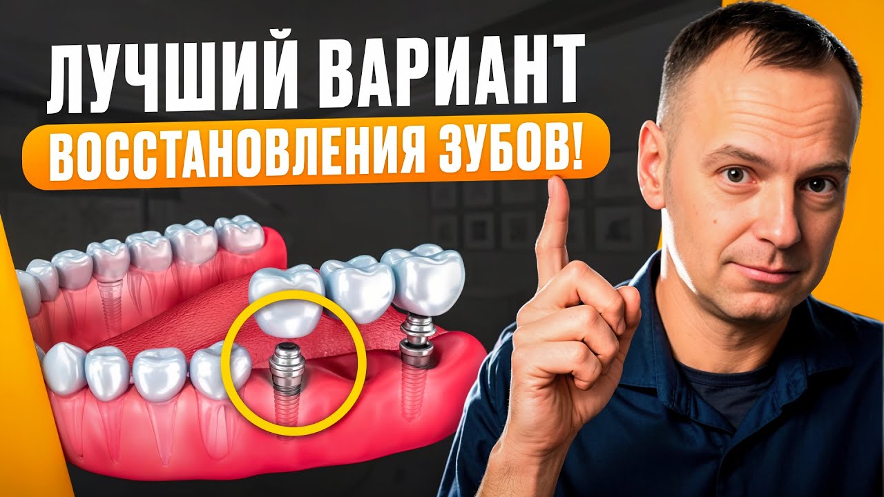 3 Варианта СЭКОНОМИТЬ на восстановлении ВАШИХ ЗУБОВ в 2026 году - об этом молчат ВСЕ!