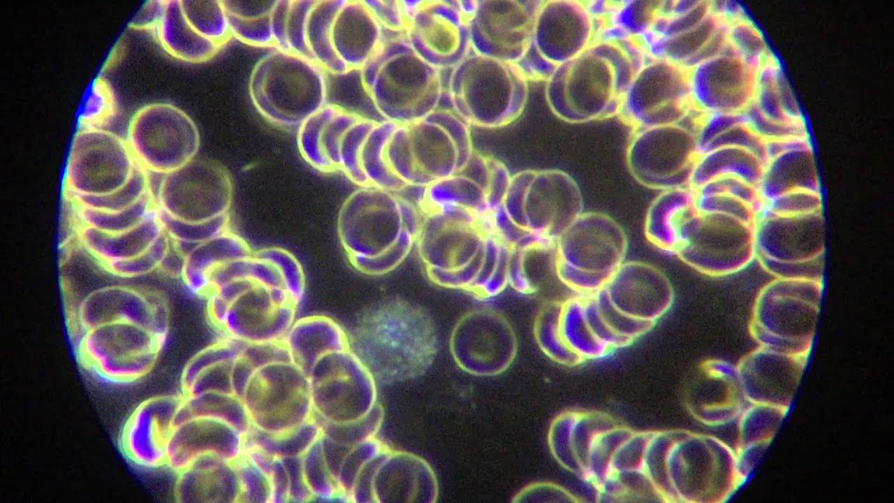 Australian Lyme Spirochete Bacteria - Dark Field 3 - April 2015