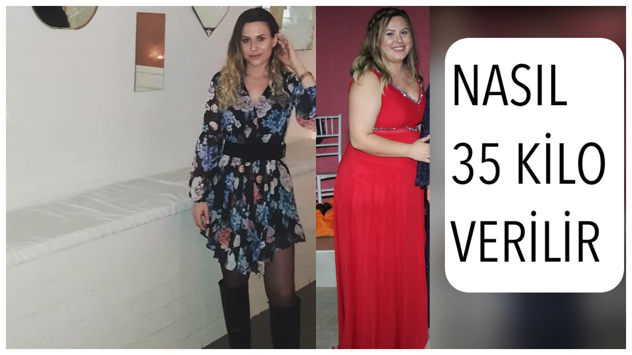 NASIL KİLO VERİLİR 🍽 DİYETİSYENSİZ , AMELİYATSIZ NASIL KİLO VERİLİR 👌