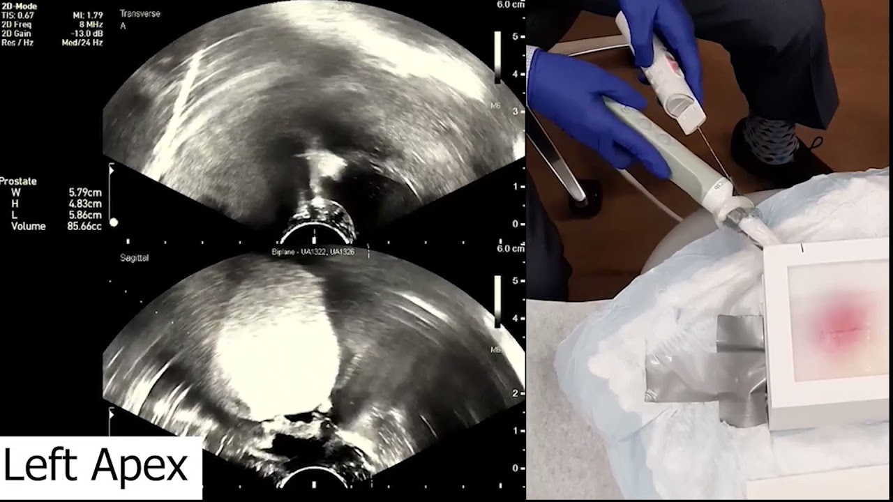 V14-01: Design and Development of a High-Fidelity Transrectal Ultrasound (TRUS) Simulation Model