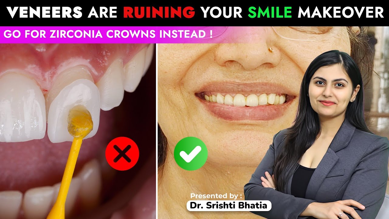 Veneers Are RUINING Your Smile Makeover! Go for Zirconia Crowns instead! Dr. Srishti Bhatia #smile