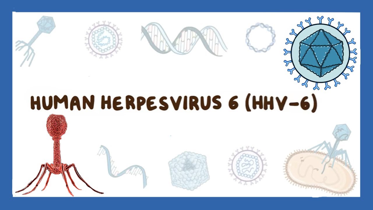 Human herpesvirus 6 Roseola