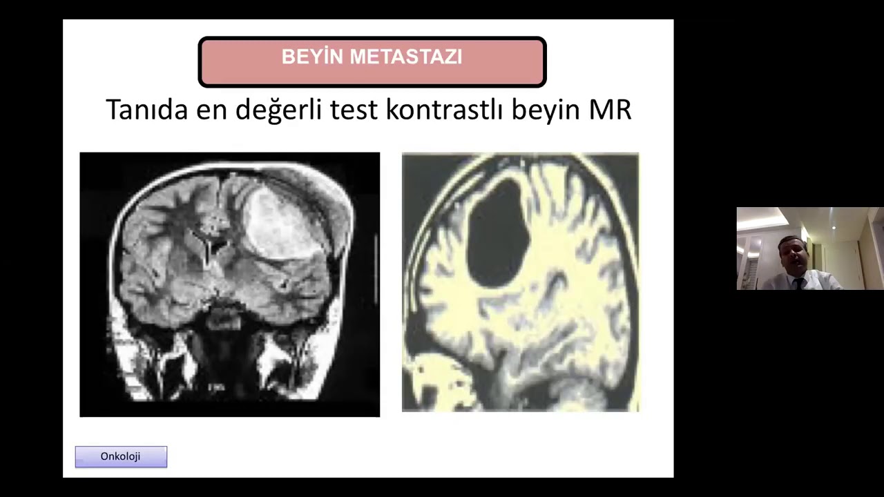 İnsanlar Neden Ölür ?  |   Prof  Dr  Nuri Karadurmuş