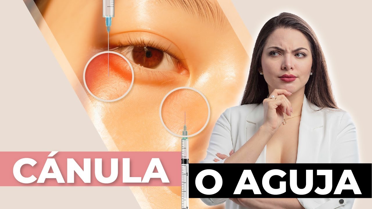 &iexcl;Descubre cu&aacute;l es mejor: c&aacute;nula o aguja!