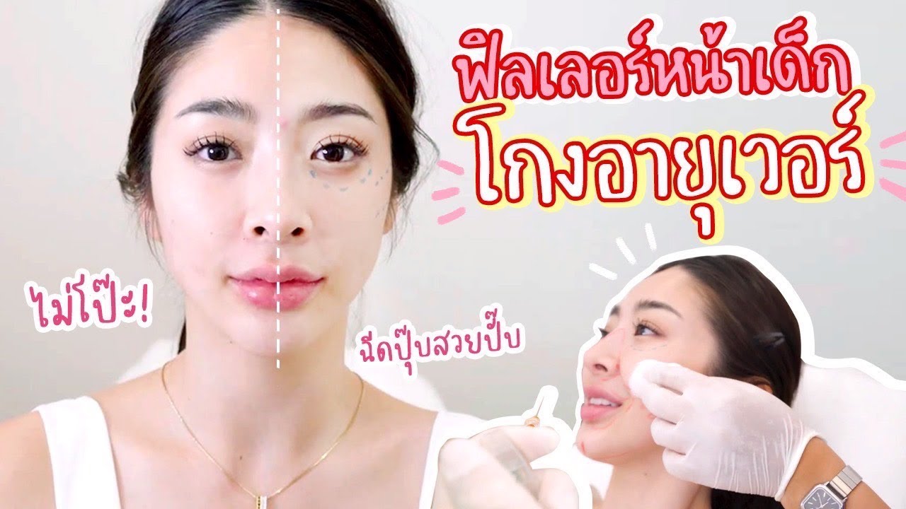 ฟิลเลอร์ทั้งหน้า เคล็ดลับหน้าเด็กตลอดไป | Nn.lardapha